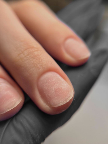 منكير علاجي ايدي  Therapeutic manicure